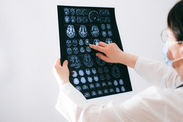 [11 milhões de pessoas morrem por ano de doenças neurológicas, aponta levantamento da OMS]