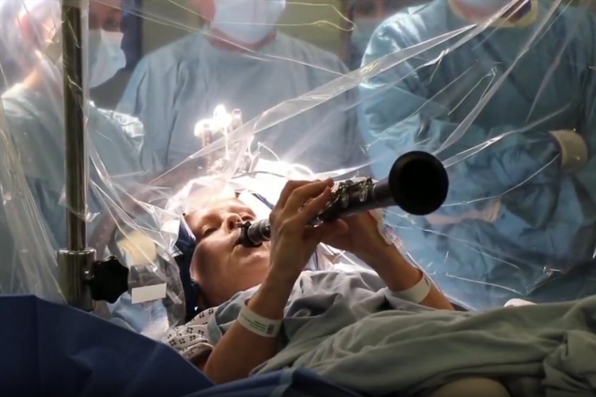 Vídeo: Mulher com Parkinson recupera movimentos e toca clarinete durante cirurgia