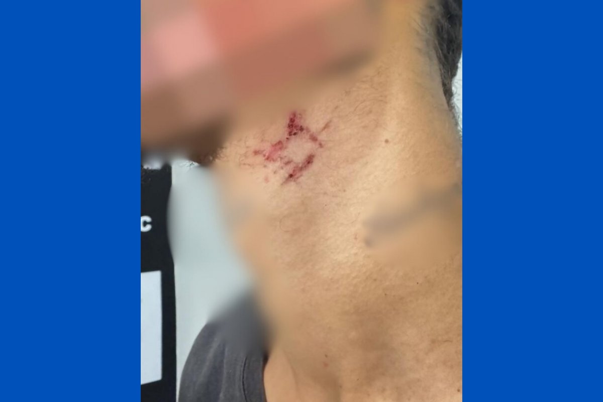 Homem é resgatado após um ano sendo escravo sexual de traficante