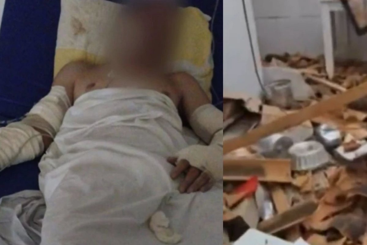 Homem fica gravemente ferido após explosão por vazamento de gás na Bahia 