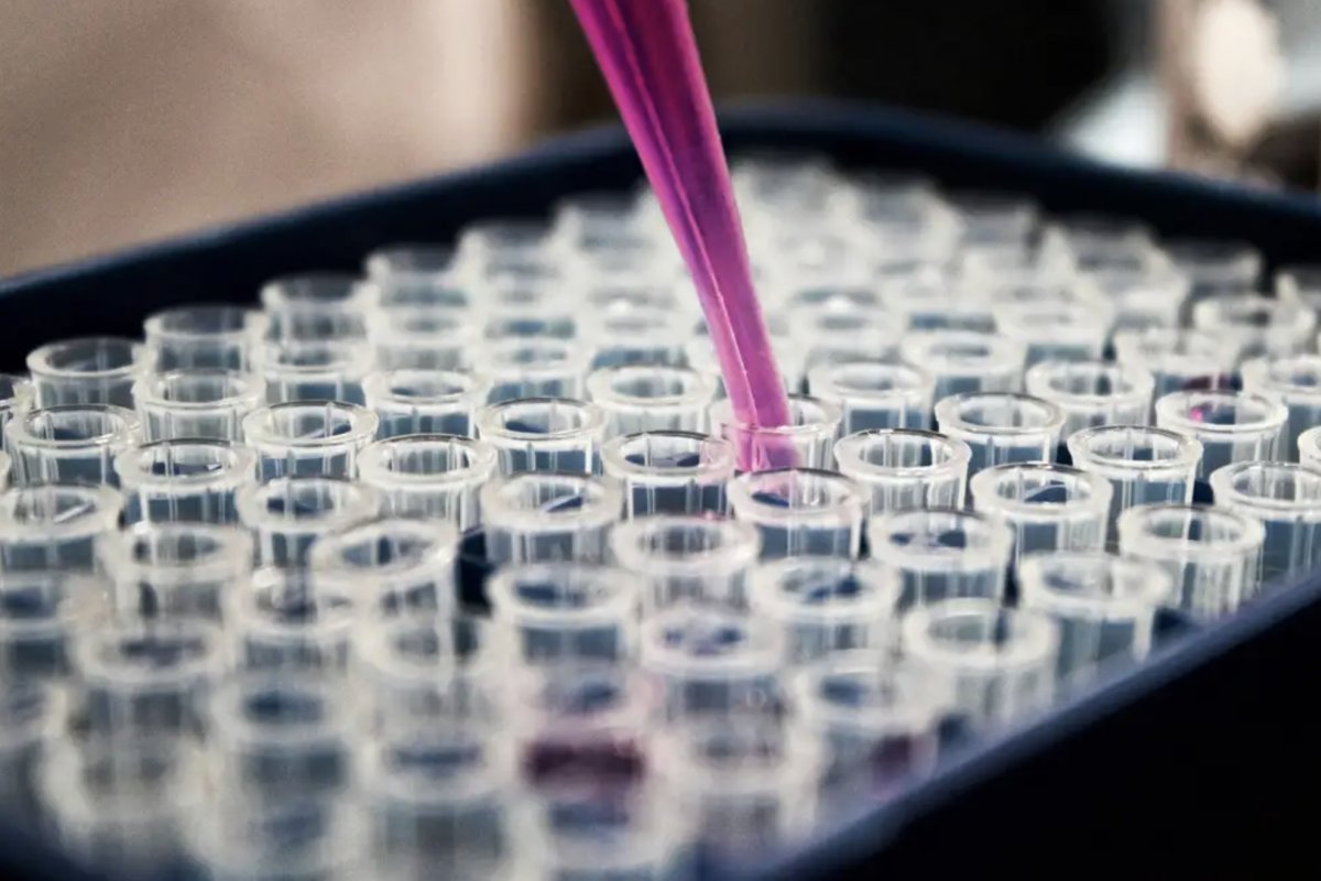 Estudo mostra que inflamação no cérebro pode ser chave do Alzheimer