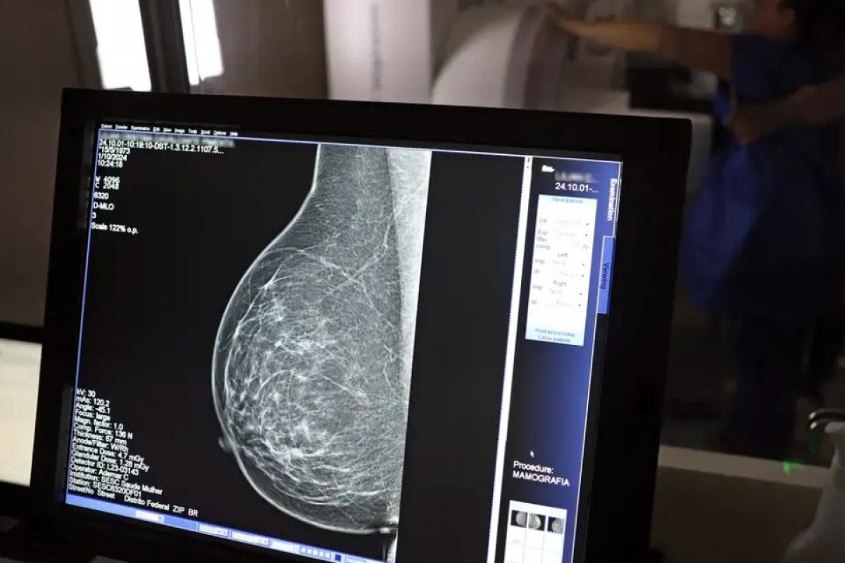 Mulher atribui diagnóstico tardio de câncer a racismo; sociedade de oncologia lança guia contra preconceito