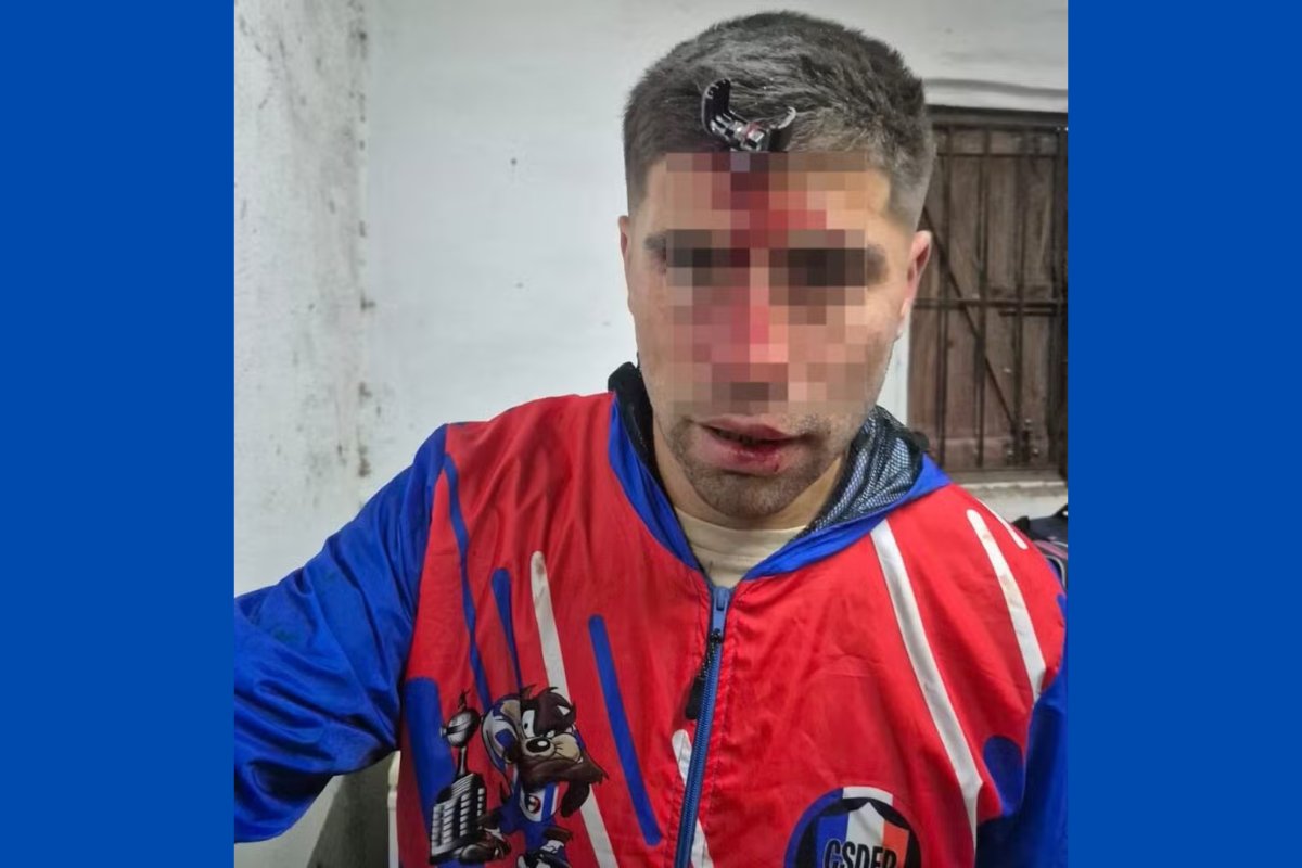 Jogador fica com chave de carro cravada na testa após briga em estádio