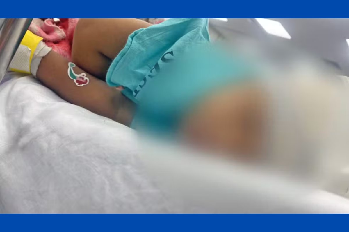 Bebê de 1 ano é baleada na cabeça após carro da família ser atacado por traficantes no Rio de Janeiro