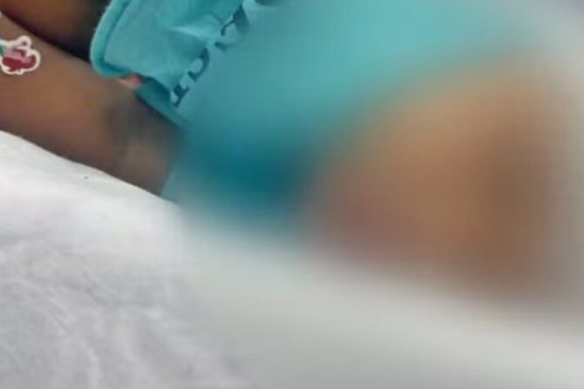 Criança de 1 ano é atingida por tiro na cabeça após suposto ataque de traficantes no RJ