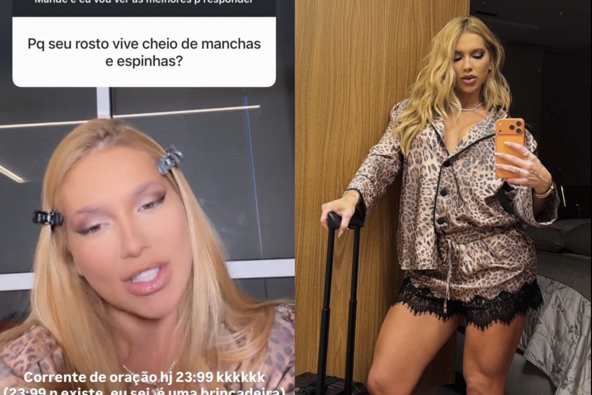 Após comentário de Virginia sobre manchas e espinhas, especialista explica relação entre hormônios e acne! 