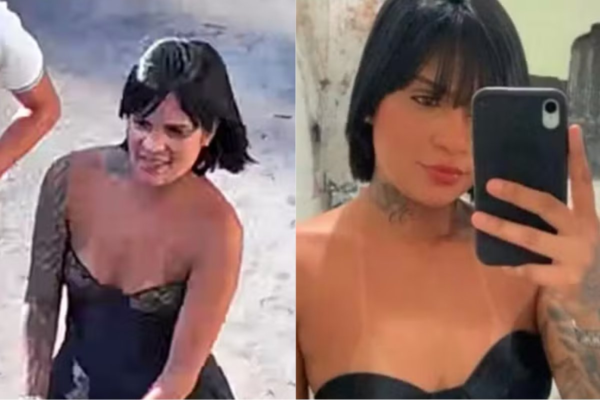 Mulher que teve pernas amputadas após ser atropelada terá de passar por nova cirurgia