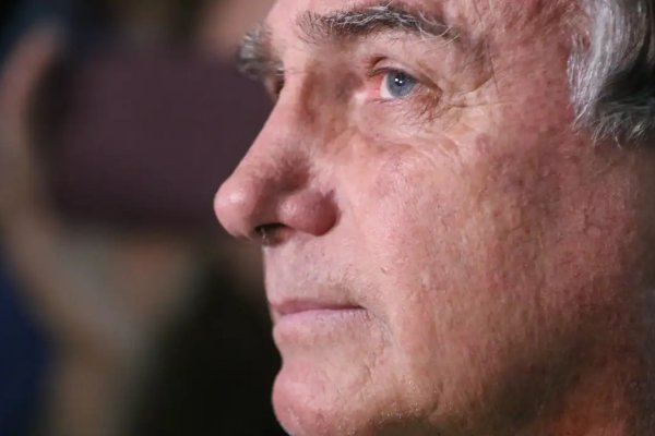 [Bolsonaro tem entre 30 a 40 soluços por minuto, diz relatório da PF]