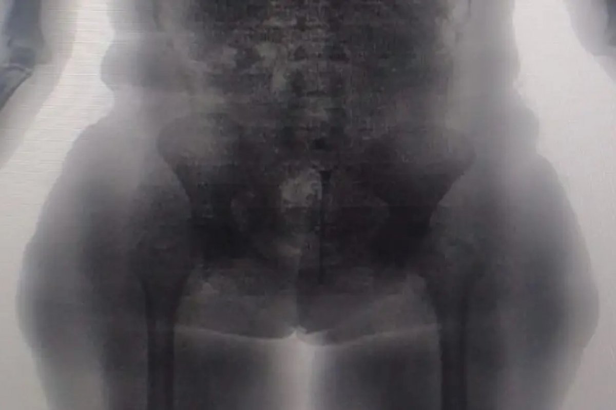 Mulher é presa ao tentar entrar em presídio da RMS com maconha e cocaína