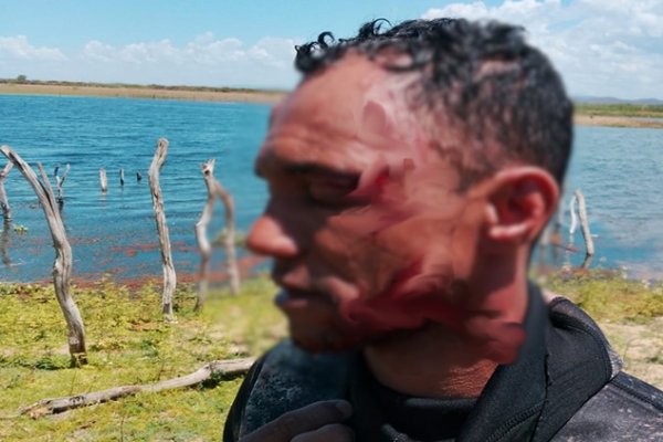 [Homem sobrevive após ataque de jacaré em rio de cidade do interior da Bahia]
