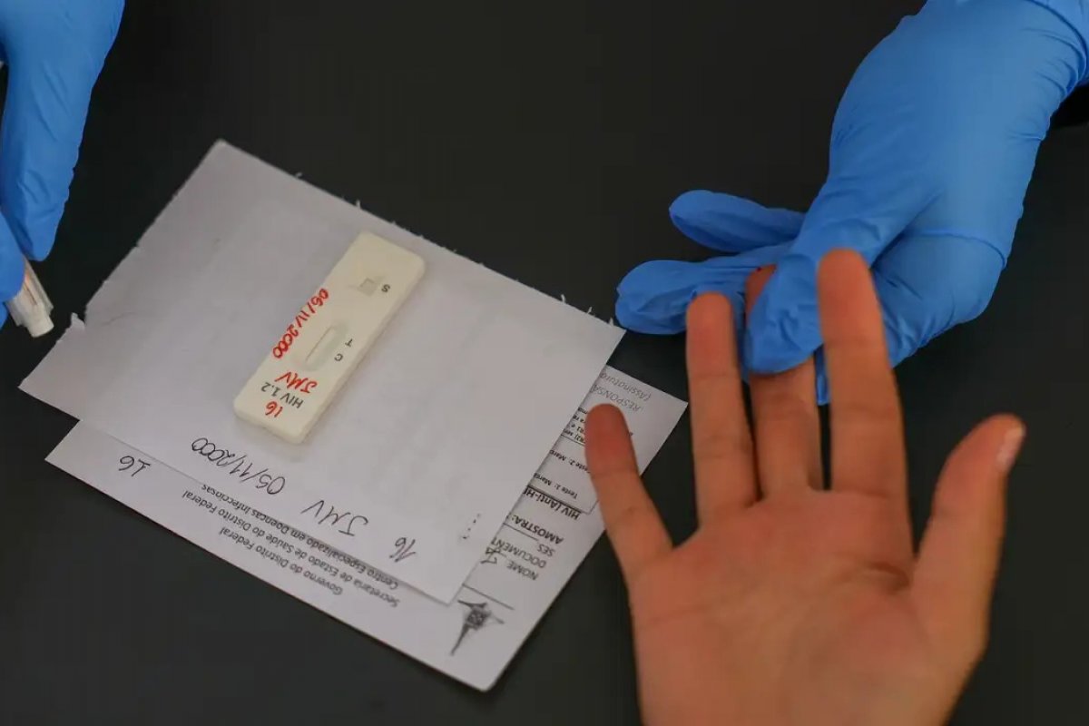 Brasil participa de pesquisa global que testa PrEP de uso mensal contra HIV