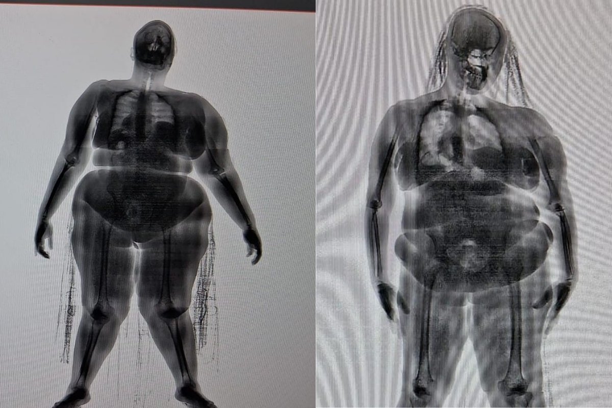 Mulheres são presas ao tentarem entrar com drogas escondidas nas partes íntimas na Cadeia Pública de Salvador