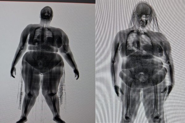 [Mulheres são presas ao tentarem entrar com drogas escondidas nas partes íntimas na Cadeia Pública de Salvador]