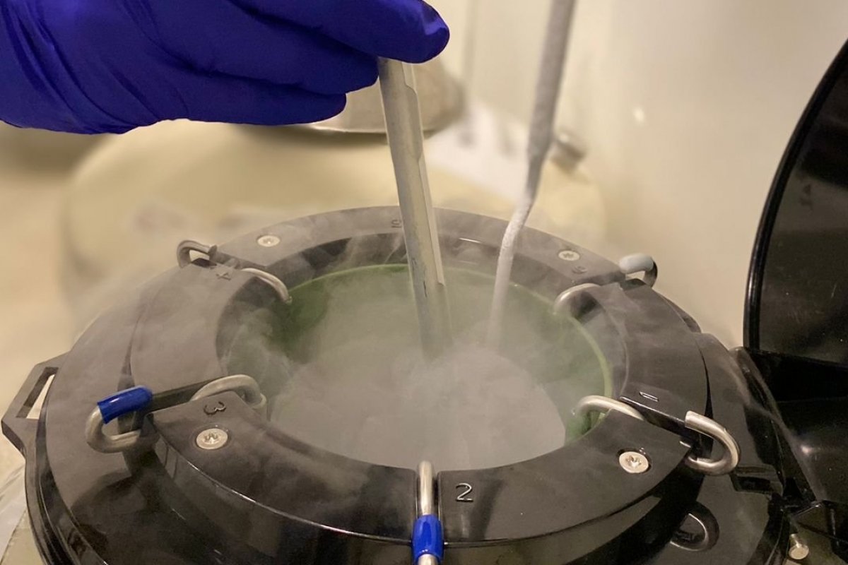 Busca por preservação da fertilidade cresce no Brasil e soma 56 mil ciclos de fertilização in vitro em 2024