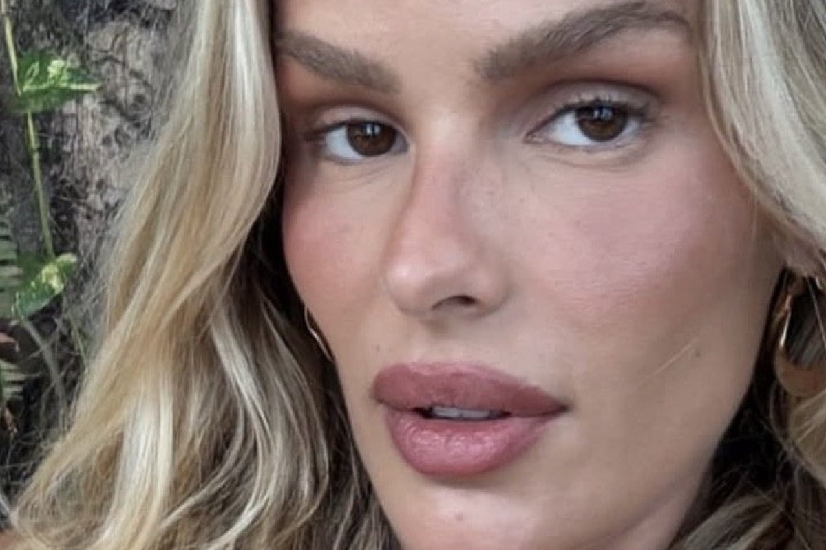 Yasmin Brunet mostra antes e depois após diagnóstico de lipedema e perda de 15 kg!