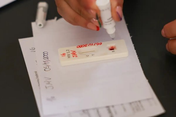 [Acordo entre farmacêutica e Fiocruz abre caminho para fabricação de injeção contra HIV no Brasil]