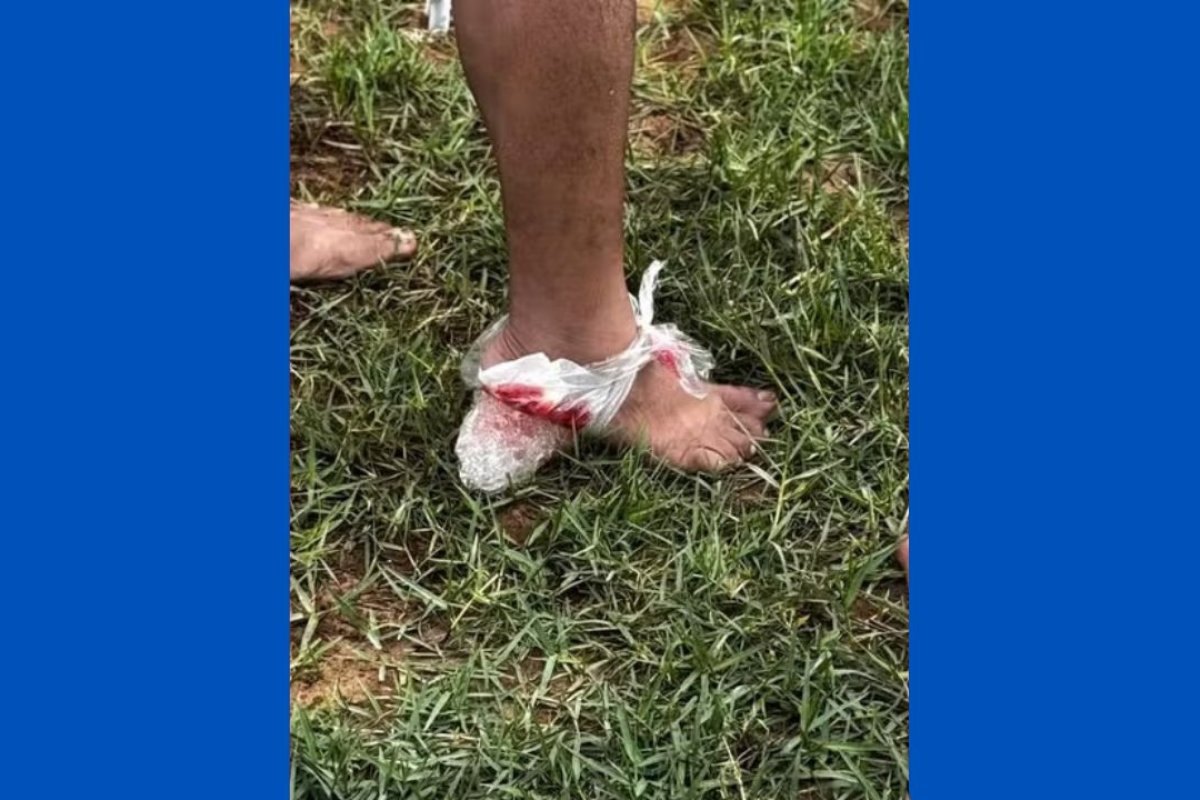 Ataque de piranhas em rio deixa dez pessoas feridas na Bahia