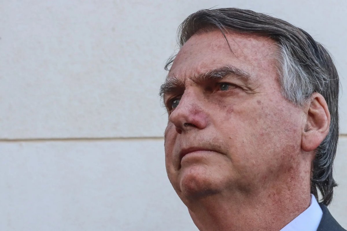 PF diz que Bolsonaro deve receber cuidados na Papudinha e não precisa ser transferido a hospital