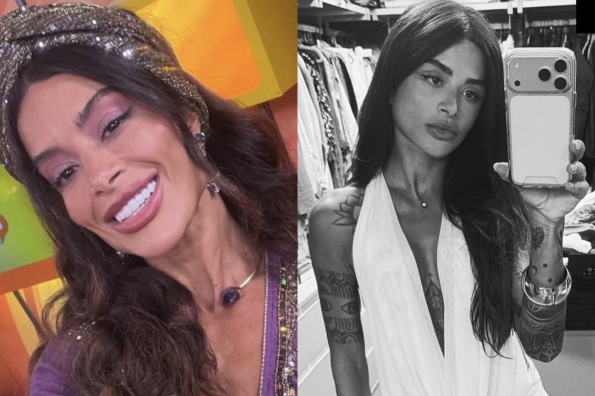 Aline Campos revela lifting facial e especialista explica cirurgia que rejuvenesce e redefine o rosto!