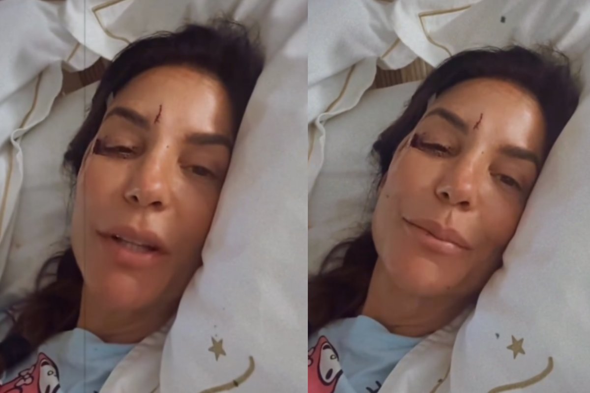 Vídeo: Ivete Sangalo surge machucada e relata desmaio após mal-estar em casa; cantora está internada