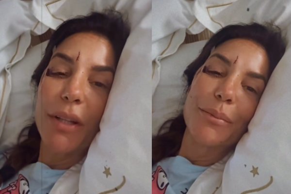 [Vídeo: Ivete Sangalo surge machucada e relata desmaio após mal-estar em casa; cantora está internada]