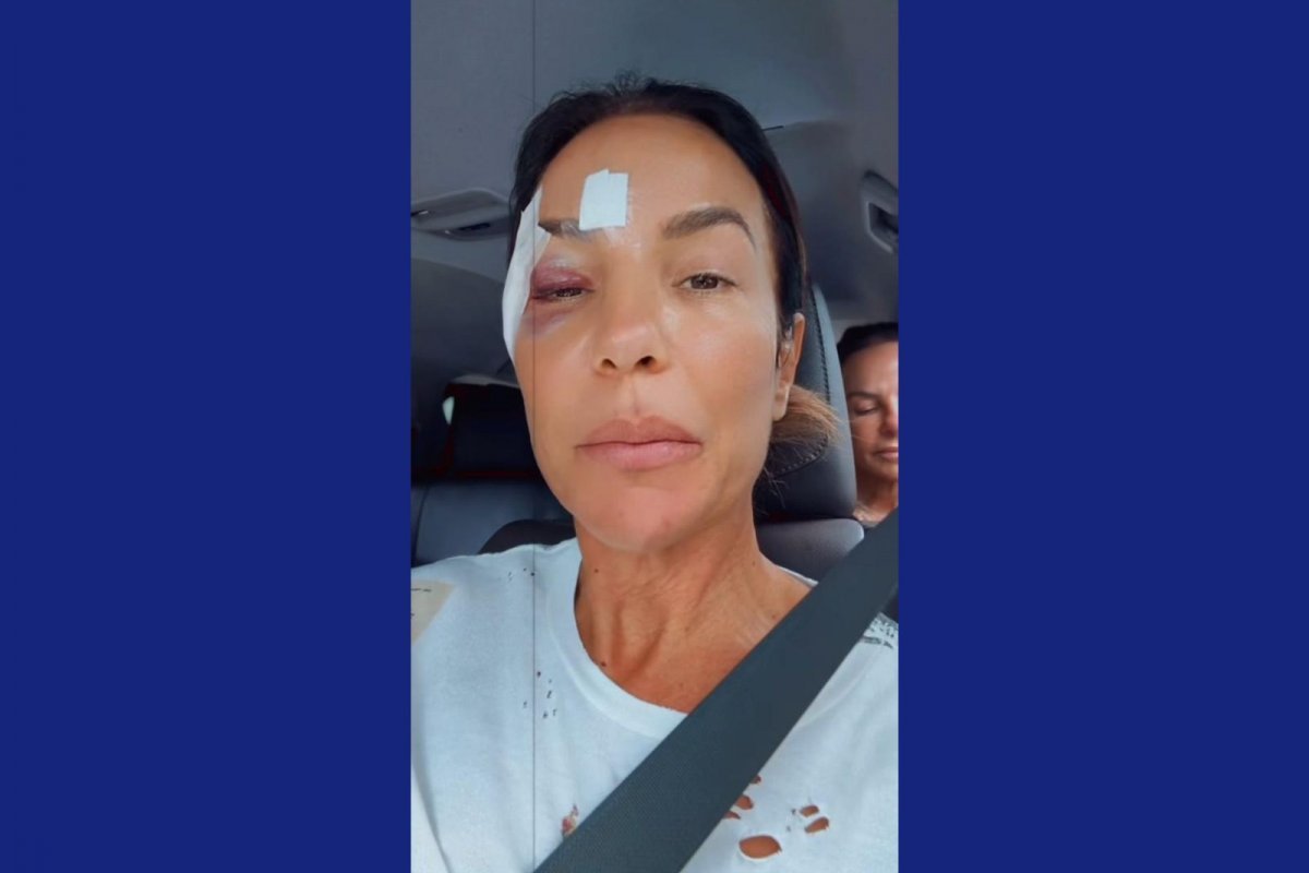 Vídeo: Ivete Sangalo passa por cirurgia após quadro de desmaio