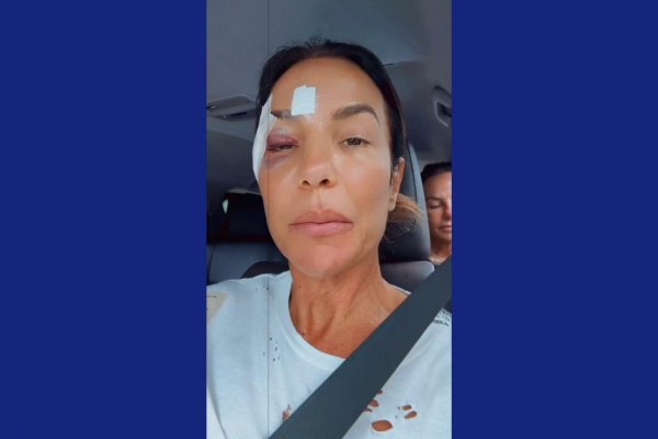 [Ivete Sangalo passa por cirurgia após quadro de desmaio]