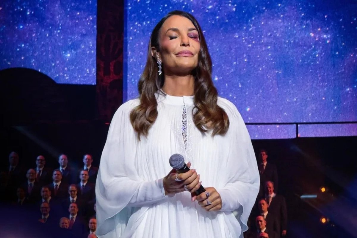 Ivete Sangalo fez cirurgia para corrigir fratura no maxilar após queda, diz coluna