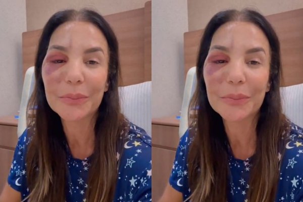 [VÍDEO: Ivete tranquiliza fãs sobre cirurgia realizada neste domingo (1)]