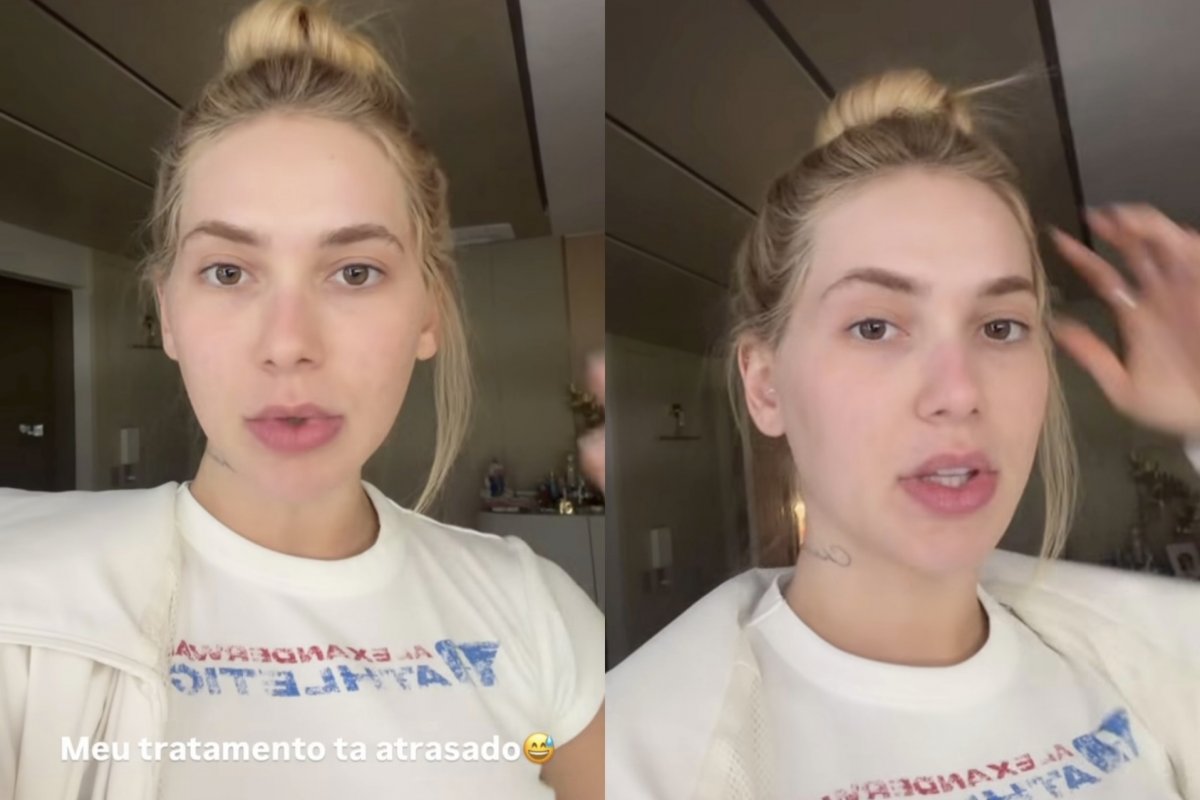 Virginia Fonseca revela atraso em tratamento e volta a sofrer com crises de enxaqueca! 