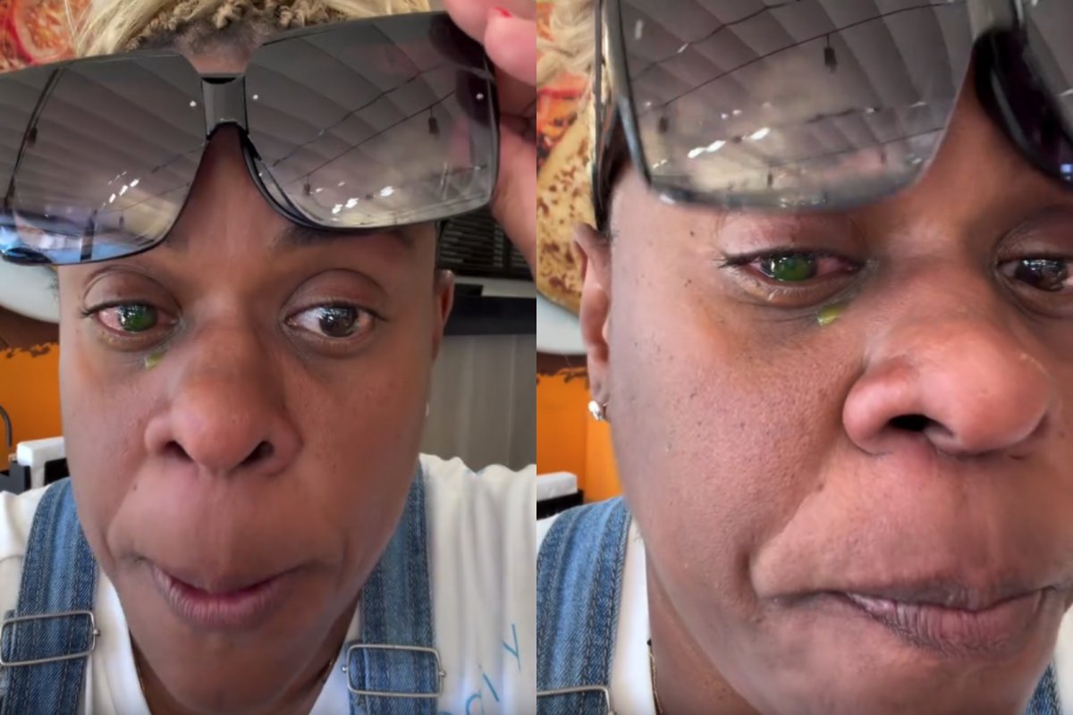 Vídeo: Cacau Protásio relata alergia grave após usar pomada capilar: "Meu olho chega a estar verde"