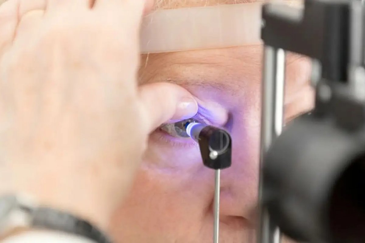 Mutirão oftalmológico deixa 26 pacientes com problemas na visão em Irecê