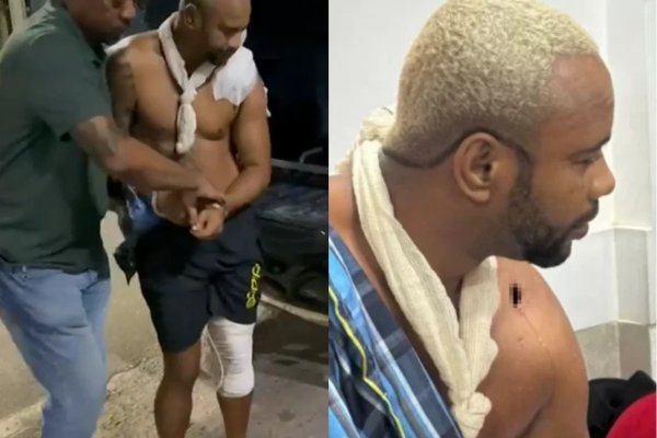 [Líder do CV do Nordeste de Amaralina é preso em hospital de Salvador após dar entrada baleado]