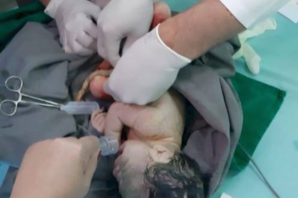 Mulher dá à luz sem saber que estava grávida no interior de São Paulo