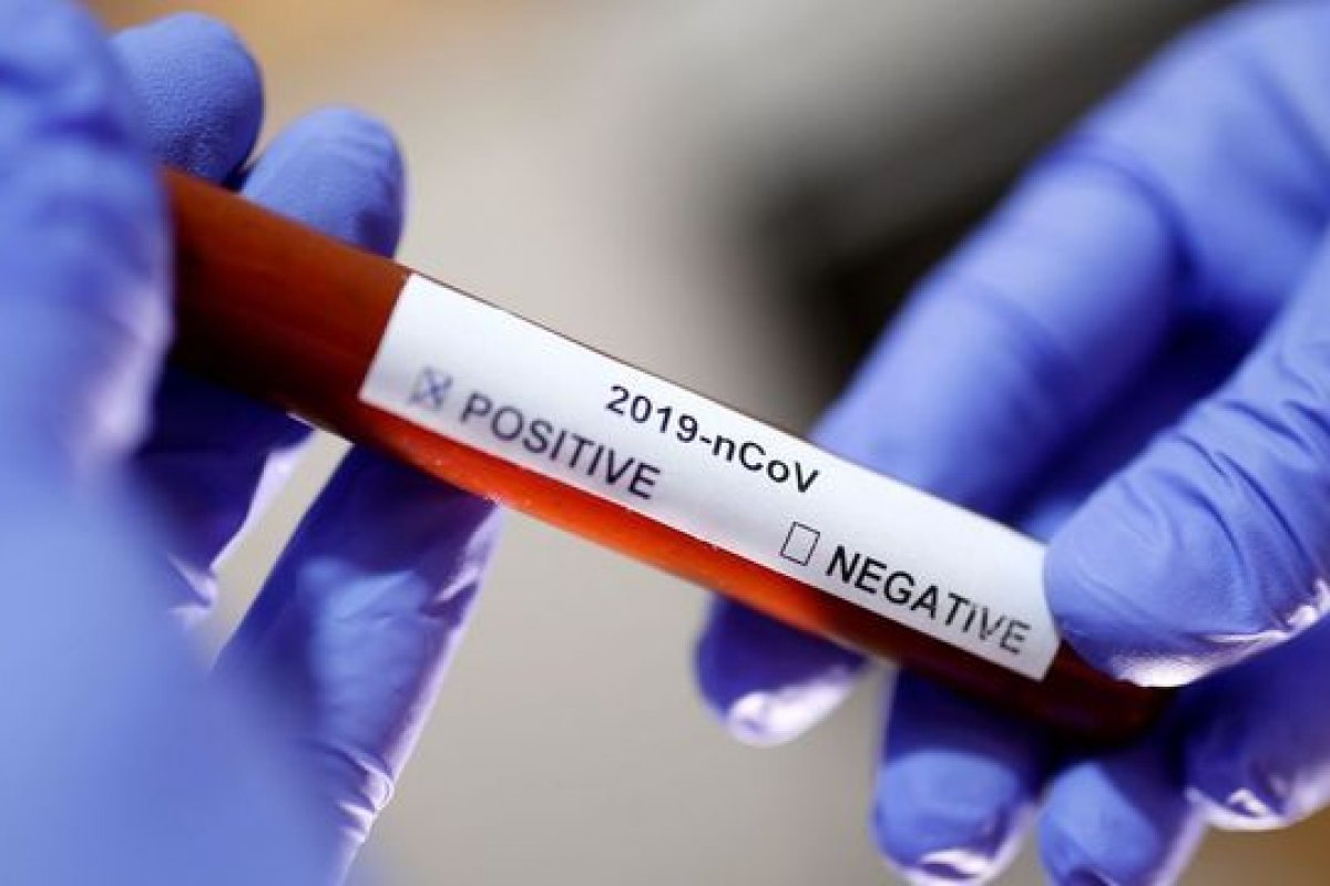 Planos de saúde devem cobrir testes para diagnóstico de novo coronavírus