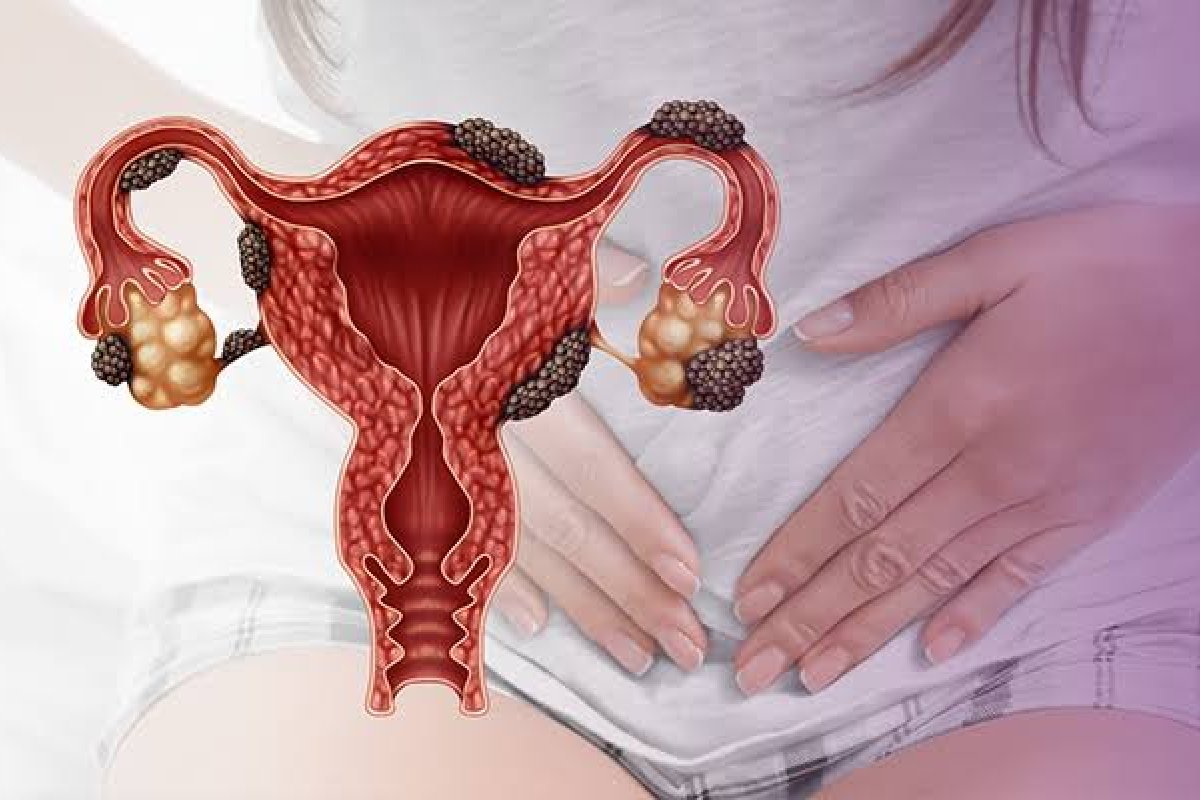 Médicos baianos com atuação consolidada em endometriose e fertilidade se unem em Salvador por um bom motivo!