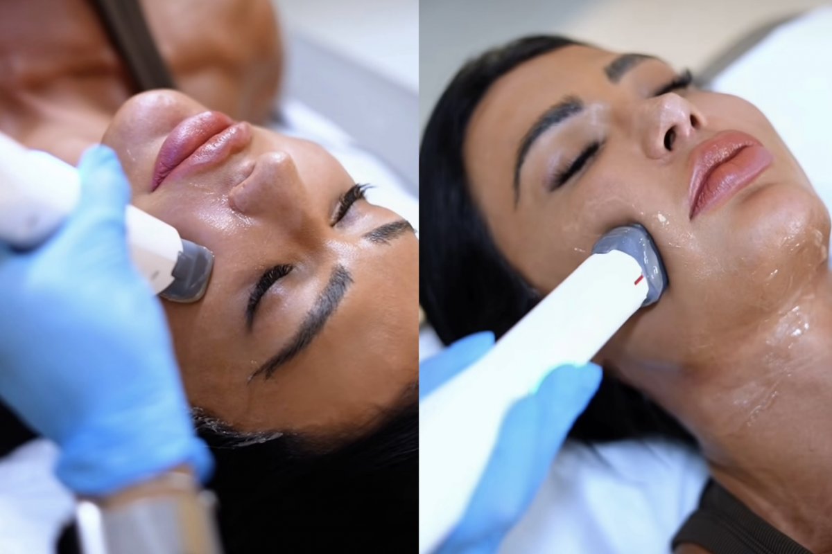 Após mudança de visual de Gracyanne Barbosa, especialista explica alta na reversão de preenchimentos! 