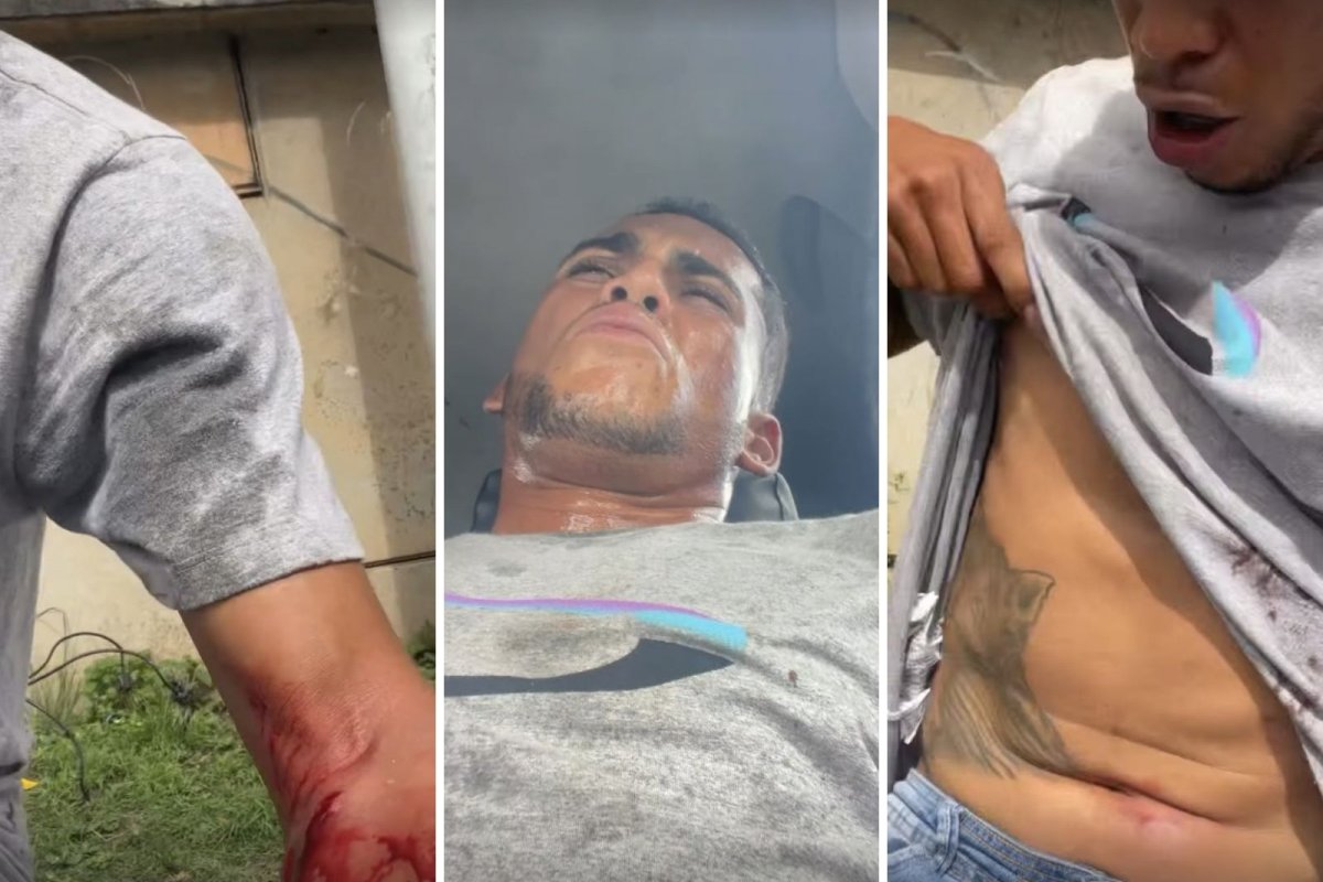 Vídeo: Influencer é baleado na Rótula do Abacaxi e posta vídeo pedindo ajuda: 'Tomei três tiros'