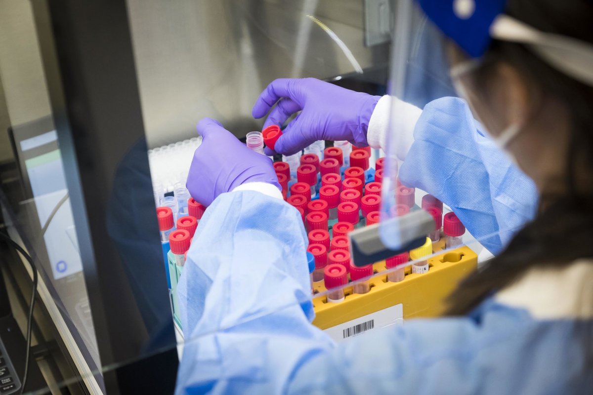 Diagnóstico molecular marca nova era no cuidado com a saúde da mulher! 