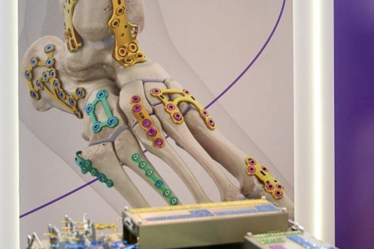 Aumento de ocorrências médicas faz mercado de dispositivos para pés e tornozelos movimentar mais de US$5 bi por ano!