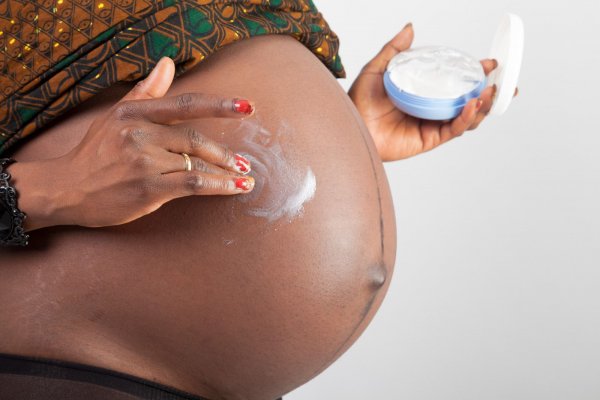 [Manchas na maternidade: por que o melasma atinge até 75% das gestantes e como tratá-lo ]