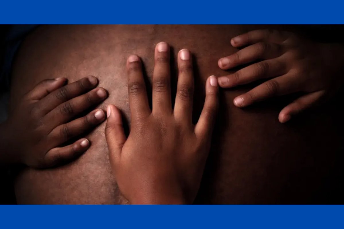 Mulheres negras sofrem maior risco de morte durante parto do que mulheres brancas; aponta estudo