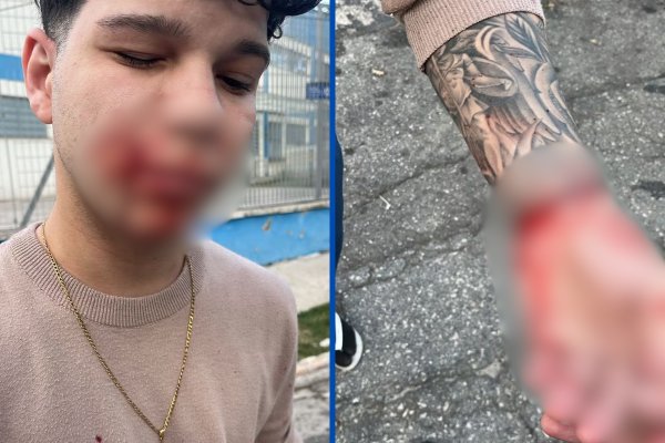 [Vídeo: 'A janela explodiu na minha cara': narra jovem vítima de explosão que atingiu imóveis em São Paulo]