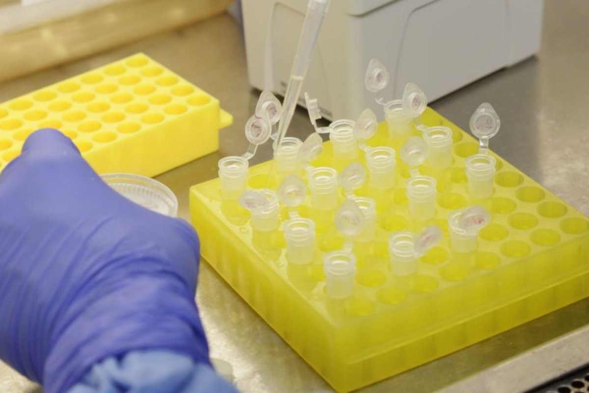 Ministério da Saúde confirma 76 casos de novo coronavírus no Brasil