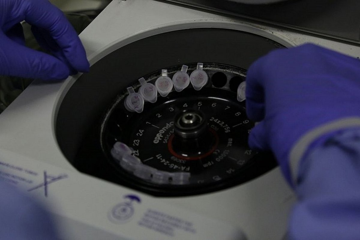 Aluno da UEFS tem suspeita de coronavírus