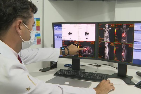 [SUS passa a oferecer novo exame para detectar câncer de intestino antes dos sintomas]