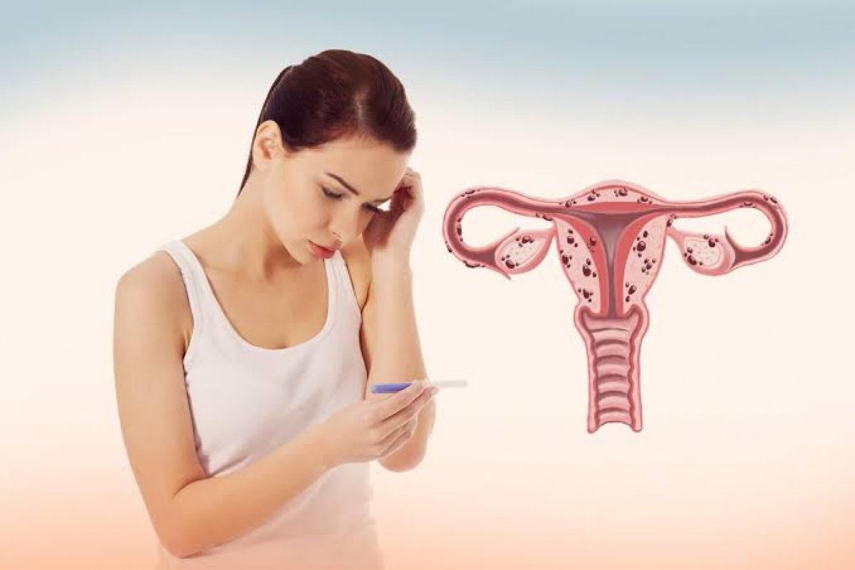 Núcleo de Endometriose e Fertilidade da Bahia (NEF) une especialistas em nova fase em Salvador!