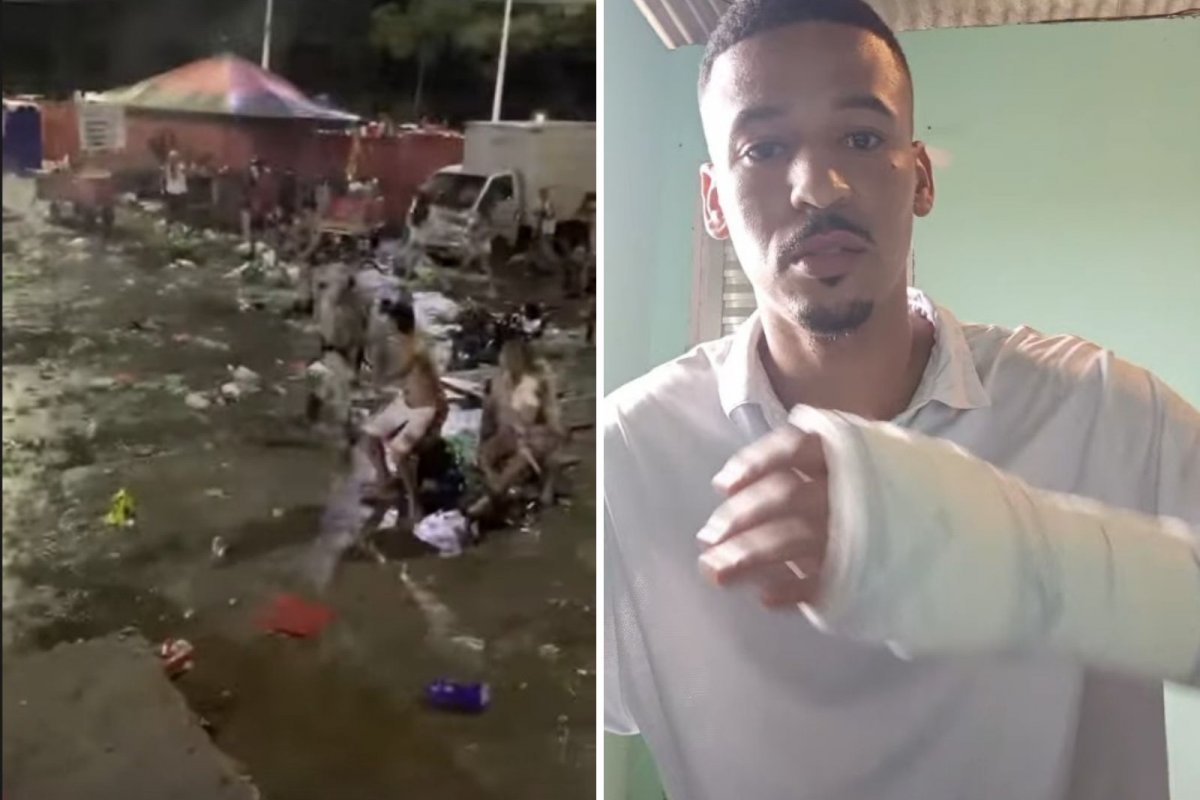 Vídeo: 'Sofri uma lesão no braço': torcedor do Vitória denuncia violência policial no estacionamento do Barradão