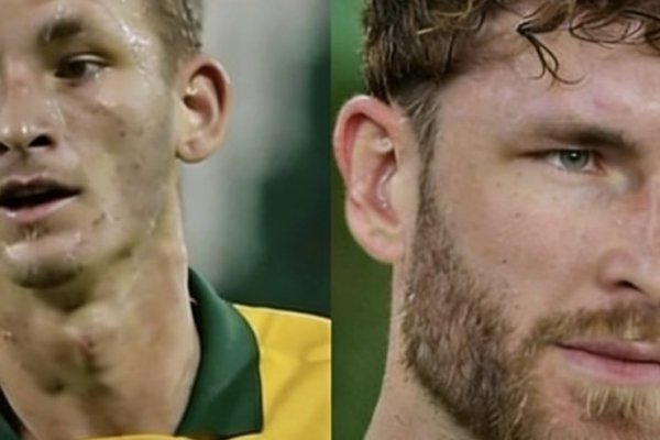 [O que explica a transformação facial de Léo Pereira, jogador da Seleção Brasileira? Especialista analisa!]
