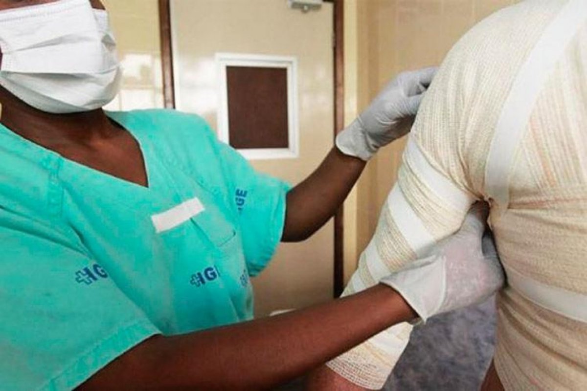 Secretaria da Saúde do Estado da Bahia registra 59 ocorrências de queimados no São João